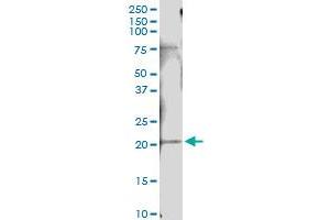 Immunoprecipitation of IFNA10 transfected lysate using anti-IFNA10 MaxPab rabbit polyclonal antibody and Protein A Magnetic Bead , and immunoblotted with IFNA10 purified MaxPab mouse polyclonal antibody (B01P) .