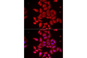 Immunofluorescence analysis of U2OS cell using TMOD4 antibody. (Tropomodulin 4 anticorps)