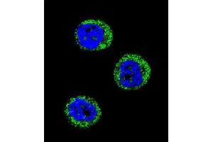 Confocal immunofluorescent analysis of HP Antibody (Center) (ABIN654637 and ABIN2844334) with MDA-M cell followed by Alexa Fluor 488-conjugated goat anti-rabbit lgG (green).