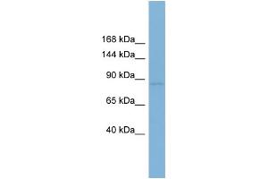 WB Suggested Anti-RSBN1  Antibody Titration: 0. (RSBN1 anticorps  (N-Term))