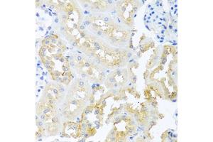 Immunohistochemistry of paraffin-embedded rat kidney using TDGF1 antibody (ABIN3021341, ABIN3021342, ABIN3021343 and ABIN6214922) at dilution of 1:100 (40x lens).