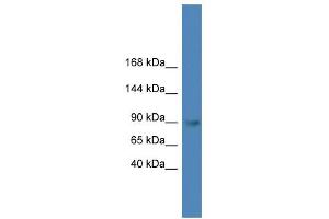WB Suggested Anti-TLR4 Antibody Titration: 0. (TLR4 anticorps  (C-Term))