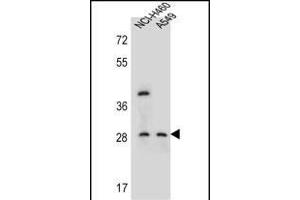 STS1 Antibody (Center) (ABIN655762 and ABIN2845205) western blot analysis in NCI-,A549 cell line lysates (35 μg/lane). (SPATS1 anticorps  (AA 172-201))