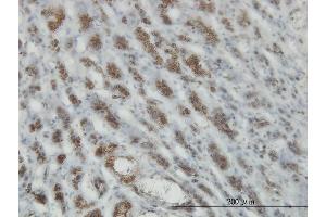 Immunoperoxidase of monoclonal antibody to RASEF on formalin-fixed paraffin-embedded human adrenal gland.