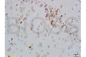 Formalin-fixed and paraffin embedded rat brain labeled with Anti-GDNF-Receptor-alpha-2 Polyclonal Antibody, Unconjugated (ABIN724235) 1:200 followed by conjugation to the secondary antibody and DAB staining (GFRA2 anticorps  (AA 301-360))