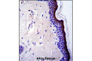 p53 Antibody (T55) (ABIN390200 and ABIN2840687) immunohistochemistry analysis in formalin fixed and paraffin embedded human skin tissue followed by peroxidase conjugation of the secondary antibody and DAB staining.