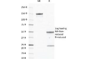 SDS-PAGE Analysis of Purified CD40 Mouse Monoclonal Antibody ABIN6383879. (CD40 anticorps  (Extracellular Domain))
