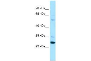 Host: Rabbit Target Name: PARS2 Sample Type: A549 Whole Cell lysates Antibody Dilution: 1. (PARS2 anticorps  (C-Term))