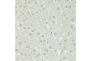 Immunohistochemistry of paraffin-embedded rat liver using SLC40A1 antibody (ABIN6292414) at dilution of 1:100 (40x lens). (SLC40A1 anticorps)
