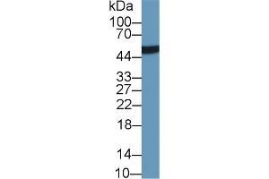 Detection of LRG1 in Human Urine using Monoclonal Antibody to Leucine Rich Alpha-2-Glycoprotein 1 (LRG1)