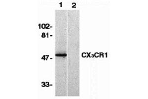 Western Blotting (WB) image for anti-Chemokine (C-X3-C Motif) Receptor 1 (CX3CR1) (N-Term) antibody (ABIN1031335)