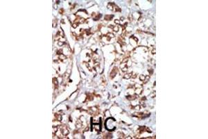 anti-Eukaryotic Translation Initiation Factor 2-alpha Kinase 1 (EIF2AK1) (AA 1-30), (N-Term) antibody