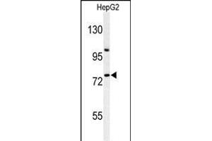 Western blot analysis of ZN Antibody (Center) (ABIN653731 and ABIN2843038) in HepG2 cell line lysates (35 μg/lane). (ZNF202 anticorps  (AA 342-370))