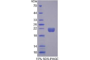 Image no. 1 for Myoglobin (MB) (AA 1-154) protein (His tag) (ABIN6236658)