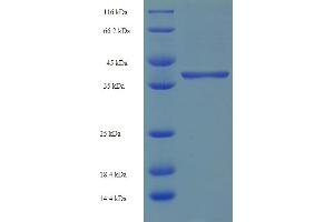SDS-PAGE (SDS) image for serine/arginine-Rich Splicing Factor 10 (SRSF10) (AA 1-183), (full length) protein (His-SUMO Tag) (ABIN5711203)