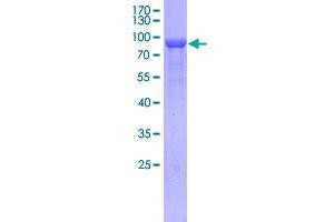 Image no. 1 for Collapsin Response Mediator Protein 1 (CRMP1) (AA 1-566) protein (GST tag) (ABIN1989606)