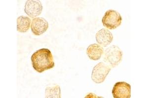 Immunocytochemistry staining of HeLa cells using AP30343PU-N FLIP antibody at 2 μg/ml. (FLIP anticorps  (C-Term))