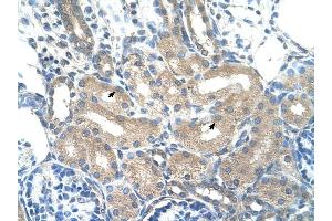 ADH1B antibody was used for immunohistochemistry at a concentration of 4-8 ug/ml to stain Epithelial cells of renal tubule (arrows) in Human Kidney. (ADH1B anticorps)