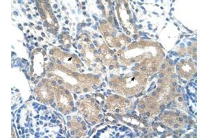 ADH1B antibody was used for immunohistochemistry at a concentration of 4-8 ug/ml to stain Epithelial cells of renal tubule (arrows) in Human Kidney.
