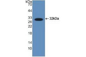Detection of Recombinant DDIT3, Human using Polyclonal Antibody to DNA Damage Inducible Transcript 3 (DDIT3) (DDIT3 anticorps  (AA 1-169))