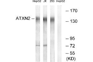Western blot analysis of extracts from HepG2 cells, Jurkat cells and 293 cells, using ATXN2 antibody. (Ataxin 2 anticorps)