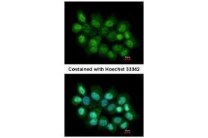 ICC/IF Image Immunofluorescence analysis of paraformaldehyde-fixed A431, using PRMT2, antibody at 1:200 dilution. (PRMT2 anticorps)