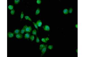 Immunofluorescence staining of SH-SY5Y cells with ABIN7166416 at 1:100, counter-stained with DAPI.