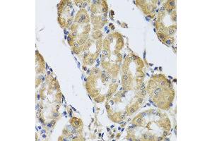 Immunohistochemistry of paraffin-embedded human gastric using CAMK2G antibody at dilution of 1:100 (x40 lens). (CAMKII gamma anticorps)