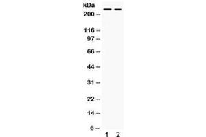 Western blot testing of human 1) SW620 and 2) HepG2 lysate with ARID1A antibody. (ARID1A anticorps)