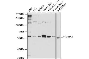 Western blot analysis of extracts of various cell lines, using EPHX2 antibody (ABIN3015667, ABIN3015668, ABIN1679738 and ABIN6219019) at 1:1000 dilution. (EPHX2 anticorps)