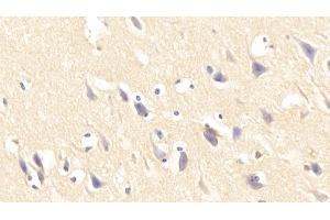 Detection of IL1RL1 in Human Cerebrum Tissue using Polyclonal Antibody to Interleukin 1 Receptor Like Protein 1 (IL1RL1) (IL1RL1 anticorps  (AA 162-349))