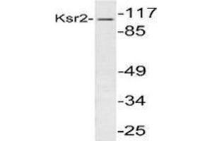 Western blot analysis of KSR2 in extracts from 293 cells using Kinase suppressor of Ras 2 antibody . (KSR2 anticorps)