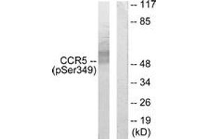 Western blot analysis of extracts from RAW264. (CCR5 anticorps  (pSer349))