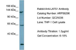 WB Suggested Anti-LATS1  Antibody Titration: 0.