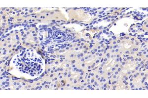 Detection of INSR in Human Kidney Tissue using Polyclonal Antibody to Insulin Receptor (INSR)