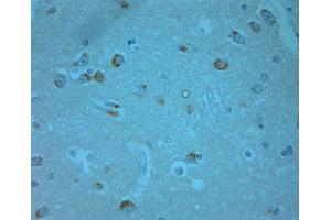 human olfactory-1 (ERK1/2 anticorps  (pThr202, pTyr204))