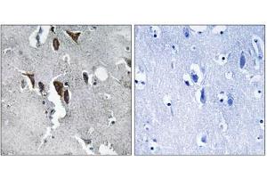 Immunohistochemistry analysis of paraffin-embedded human brain tissue using ELOVL5 antibody. (ELOVL5 anticorps  (C-Term))