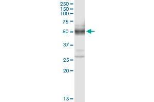 Immunoprecipitation of PLA2G15 transfected lysate using anti-PLA2G15 MaxPab rabbit polyclonal antibody and Protein A Magnetic Bead , and immunoblotted with PLA2G15 purified MaxPab mouse polyclonal antibody (B01P) .