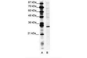 Image no. 1 for anti-Ring Finger Protein 141 (RNF141) (AA 96-145) antibody (ABIN202098) (RNF141 anticorps  (AA 96-145))