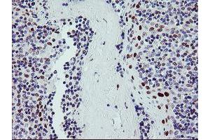 Image no. 1 for anti-BTB and CNC Homology 1, Basic Leucine Zipper Transcription Factor 1 (BACH1) antibody (ABIN1496803)