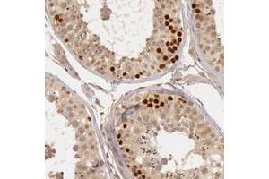 Immunohistochemical staining of human testis with CTCFL polyclonal antibody  shows strong nuclear positivity in primary spermatocytes. (CTCFL anticorps)