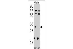 Western blot analysis of UCK2 polyclonal antibody  pre-incubated with and without blocking peptide (BP7192a) in HeLa cell line lysate. (UCK2 anticorps  (N-Term))