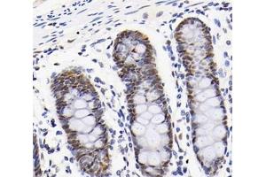 Immunohistochemistry analysis of paraffin-embedded human colon using,RBM14 (ABIN7075474) at dilution of 1: 2000 (RBM14 anticorps)