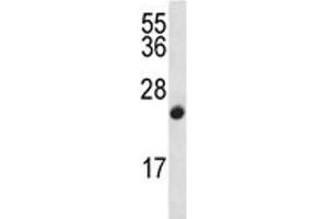 CDKN2B antibody western blot analysis in CEM lysate (CDKN2B anticorps  (AA 103-131))