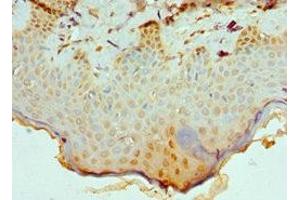 Immunohistochemistry of paraffin-embedded human skin tissue using ABIN7147709 at dilution of 1:100