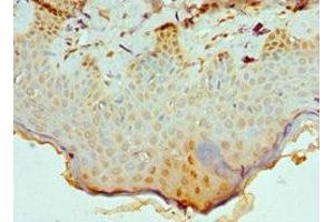 Immunohistochemistry of paraffin-embedded human skin tissue using ABIN7147709 at dilution of 1:100 (CBX8 anticorps  (AA 80-280))