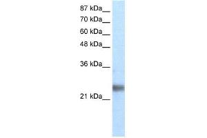 Transfected 293T; WB Suggested Anti-ZNF313 Antibody Titration: 1.