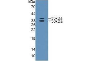 Detection of Recombinant MTUS1, Human using Polyclonal Antibody to Mitochondrial Tumor Suppressor 1 (MTUS1)