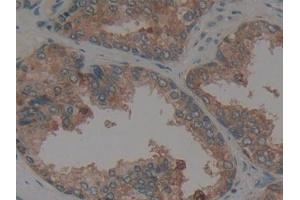 Detection of CX3CL1 in Human Prostate Tissue using Polyclonal Antibody to Chemokine C-X3-C-Motif Ligand 1 (CX3CL1)