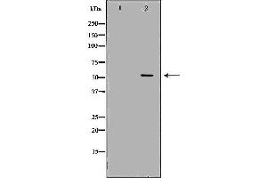 Western blot analysis of Hela whole cell lysates, using CETP Antibody. (CETP anticorps)